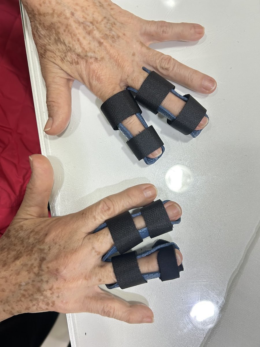Órtese Dinâmica de Extensão