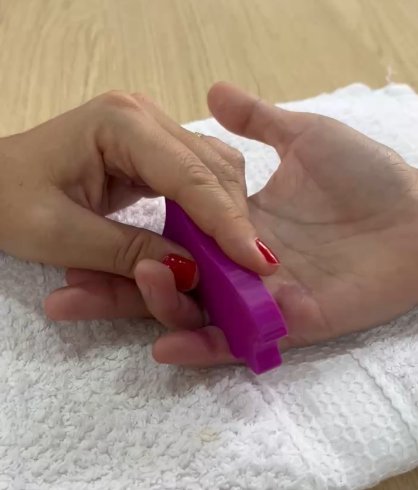 Manejo de Cicatriz Palmar